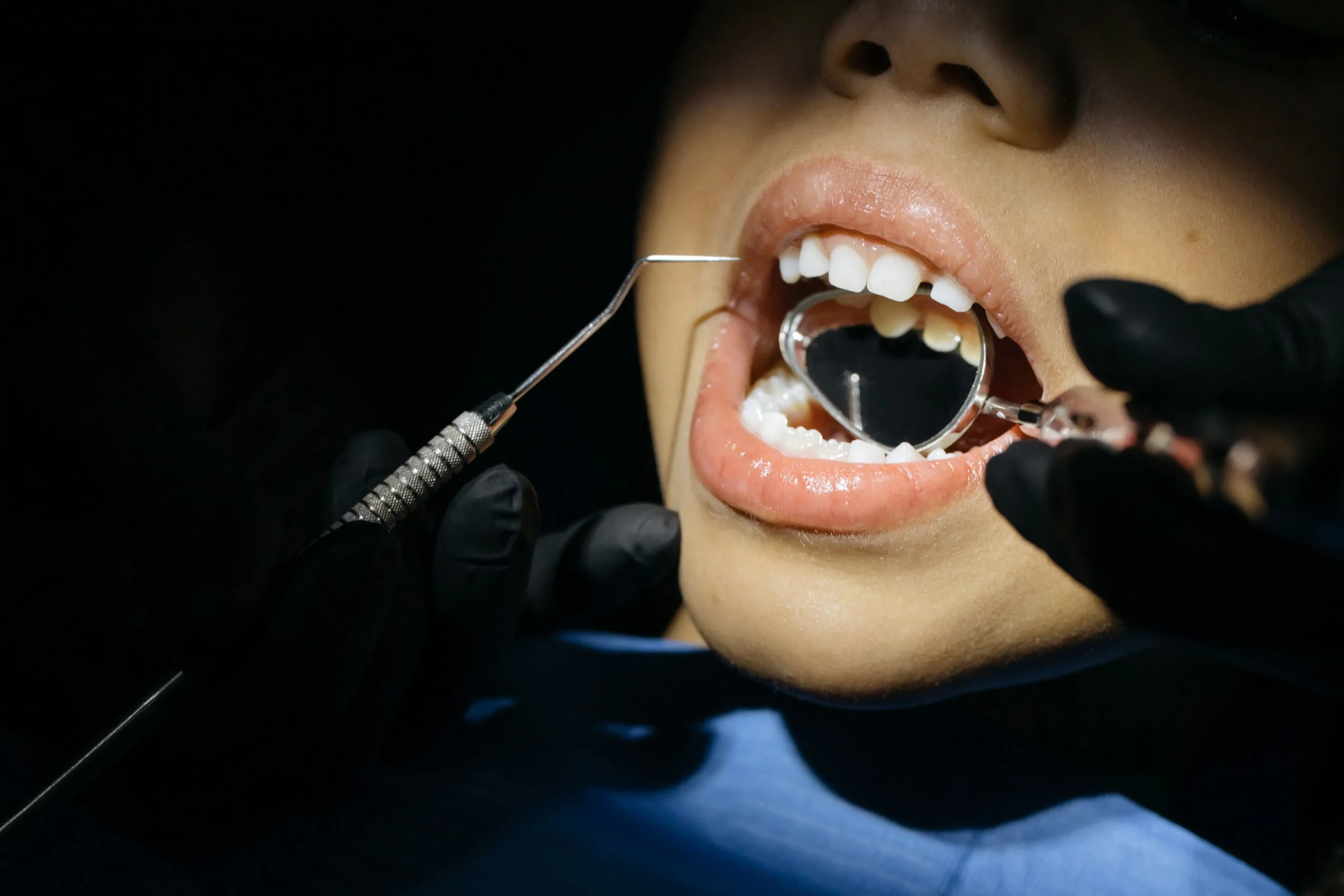 photo of a child getting his teeth checked by a pediatric dentist