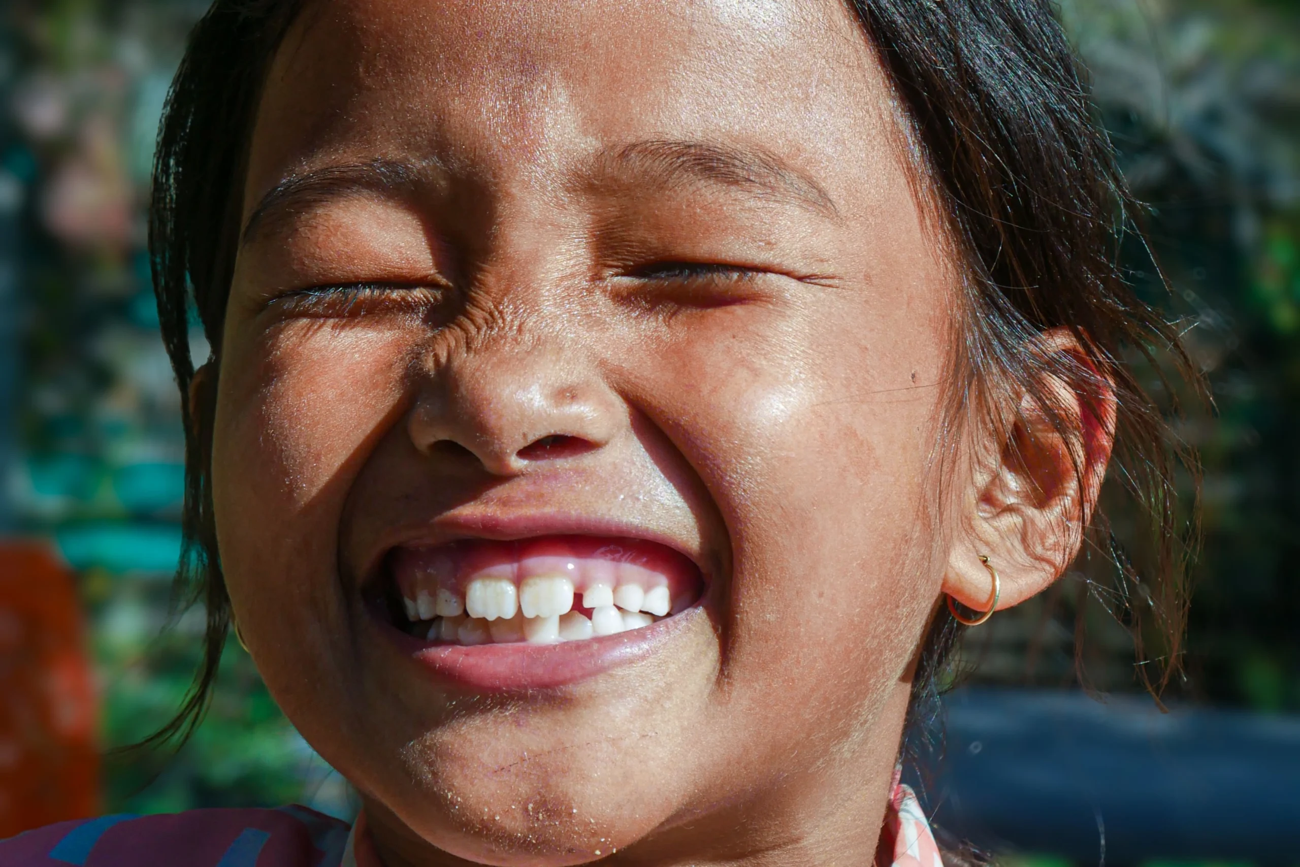 photo-of-a-girl-smiling-with-her-teeth-for-pediatric-dental-crowns